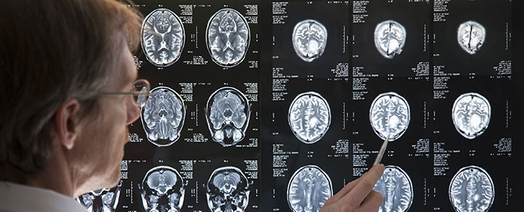 Image of man standing in front of brain scans