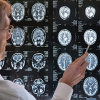 Traumatic Brain Injuries